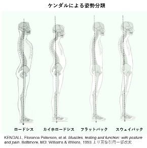 横から見た場合の背骨歪みは４タイプ！骨盤矯正と肋骨の歪み改善に一番大切なポイントは〇〇